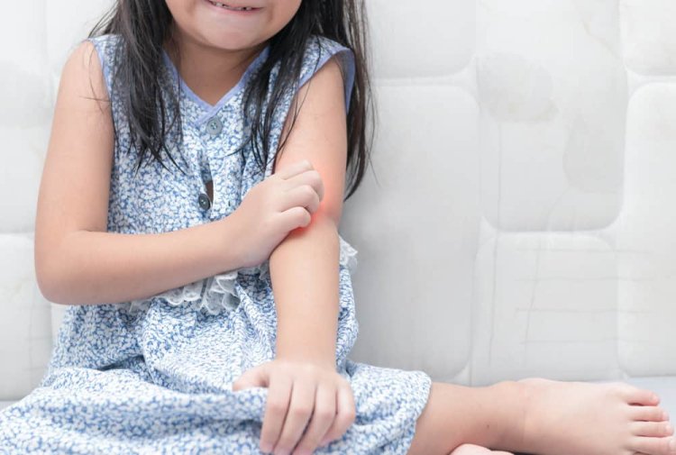 Food Allergies in Children